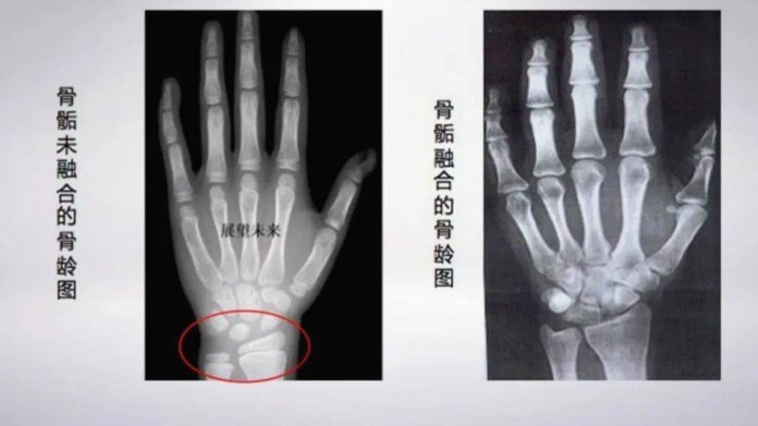 让小黑测骨龄不是董路先说然后宝库跟进的吗