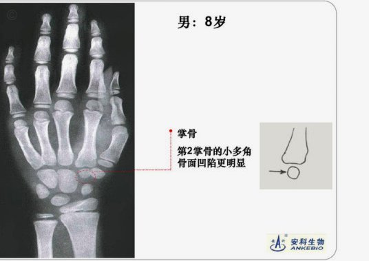 让小黑测骨龄不是董路先说然后宝库跟进的吗